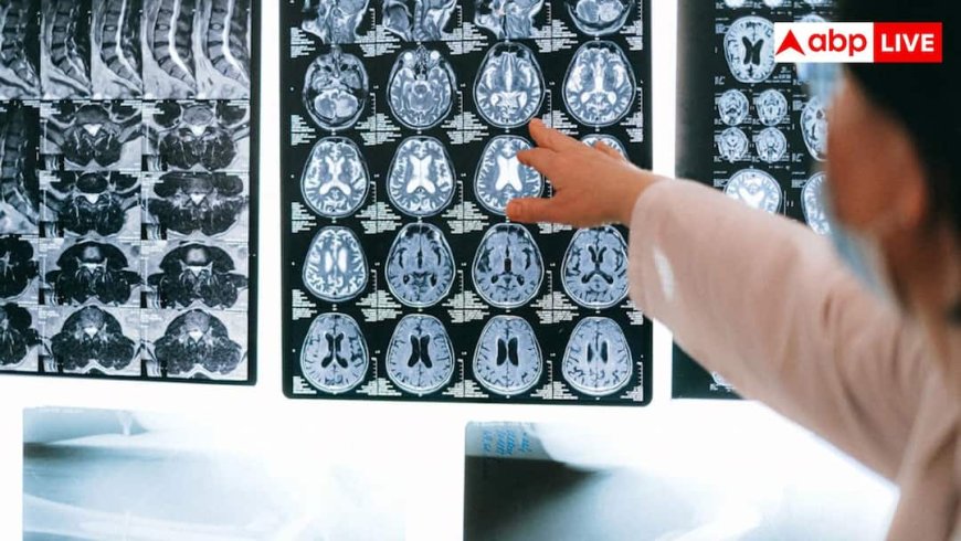 35 से 45 उम्र में हो गईं हार्ट की बीमारियां तो डिमेंशिया का भी बढ़ेगा खतरा, इस स्टडी में डराने वाला खुलासा