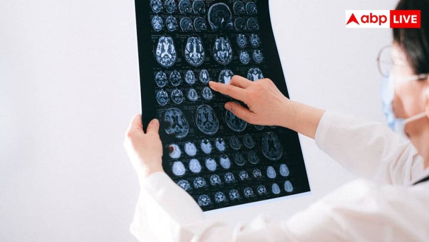 जल्दी दिमागी कमजोरी से बचना है? अपनाएं ब्रेन को फिट रखने वाले 5 जरूरी नियम