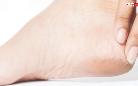 सर्दियों में फटी एड़ियों से हो गए हैं परेशान, तो घर पर ही बनाएं ये बेहतरीन क्रीम