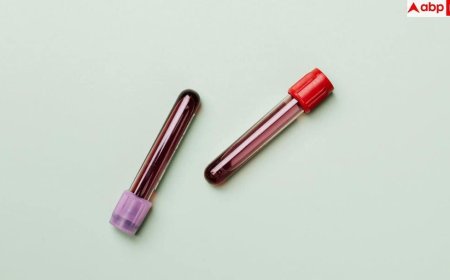 Blood Test Health Risk: ब्लड टेस्ट में छुपा है बीमारी और मौत का खतरा, रिसर्च में चौंकाने वाला दावा