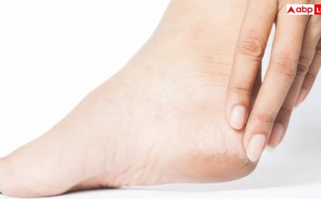 सर्दियों में फट रही हैं आपकी एड़ियां तो न हों परेशान, ये नुस्खे आएंगे बड़े काम