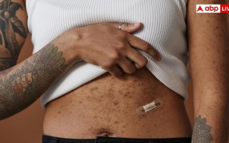 किन लोगों को हो जाती है सोराइसिस की बीमारी, इससे कैसे बचें?