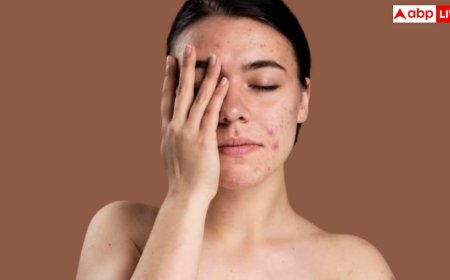क्या ड्राई स्किन को लेकर आपने भी पाल रखी हैं ये गलतफहमियां, प्रॉब्लम से पहले जानें समाधान