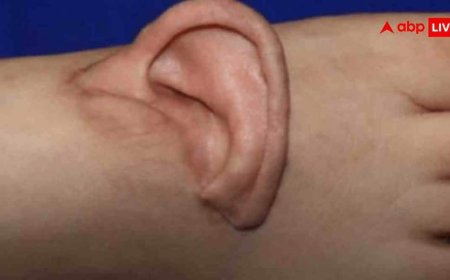 भयानक हादसे में कट गया महिला का कान, डॉक्टरों ने पैर में जोड़ कर दी अनोखी सर्जरी