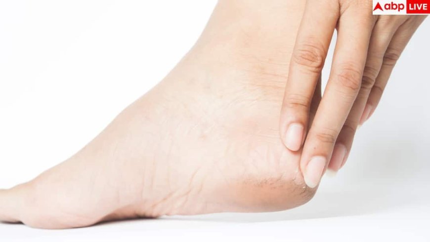 Winter Cracked Heels: सर्दियों में ही क्यों फटती हैं एड़ियां, क्या है इस दिक्कत से निपटने का तरीका?