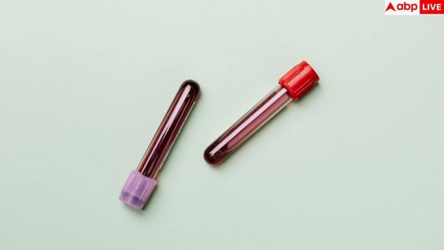 Blood Test Health Risk: ब्लड टेस्ट में छुपा है बीमारी और मौत का खतरा, रिसर्च में चौंकाने वाला दावा