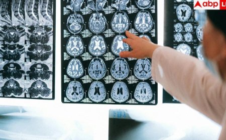 Young Onset Dementia: 24 की उम्र में 70 साल जैसा दिमाग, पढ़ें कैसे खतरनाक बीमारी ने छीन ली आंद्रे यारहम की जिंदगी?