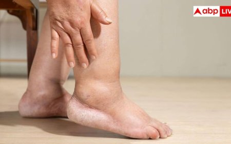 पैर में सूजन को हल्के में लेने की न करें गलती, दिल की बीमारी का हो सकता है संकेत