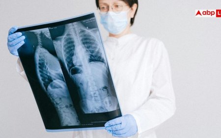 CT Scan Vs X Ray: सीटी स्कैन और एक्सरे में क्या होता है अंतर, किस बीमारी में कौन-सा कराना जरूरी?
