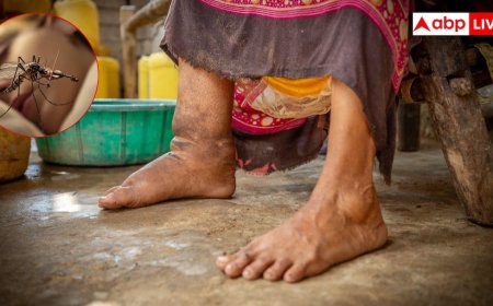 क्या होती है हाथी पांव वाली बीमारी, क्या इसमें सच में हाथी जैसा हो जाता है पैर?