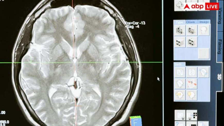 दिमाग के कीड़ों से बच्चों को कैसे पड़ते हैं दौरे? डॉक्टर से समझें खतरा और बचने के तरीके