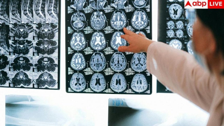 Young Onset Dementia: 24 की उम्र में 70 साल जैसा दिमाग, पढ़ें कैसे खतरनाक बीमारी ने छीन ली आंद्रे यारहम की जिंदगी?
