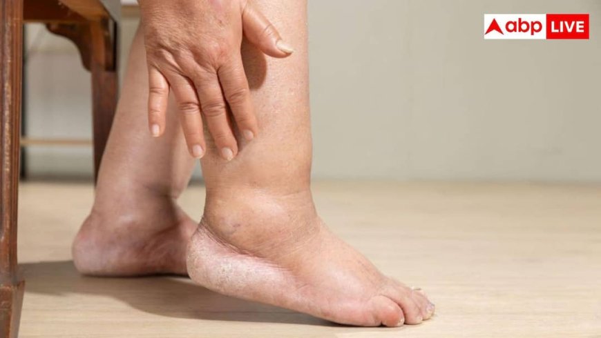 पैर में सूजन को हल्के में लेने की न करें गलती, दिल की बीमारी का हो सकता है संकेत