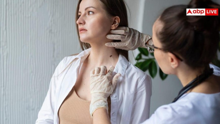 Skin Cancer: सावधान! सिर्फ धूप से ही नहीं, शरीर के इन 'छिपे हुए' हिस्सों में भी हो सकता है स्किन कैंसर