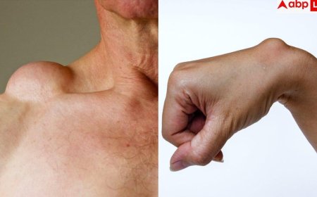 Causes Of Body Lumps: शरीर पर बार-बार आ रही है सूजन या बन रही है गांठ, जानिए कब हो जाना चाहिए सावधान?