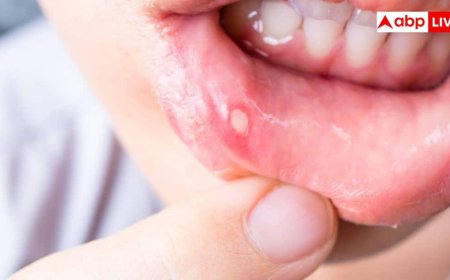मुंह के छोटे घाव बन सकते हैं कैंसर की चेतावनी, 2 हफ्ते में न भरें तो न करें नजरअंदाज