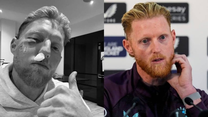 Ben Stokes Injury: टी20 वर्ल्ड कप से पहले बेन स्टोक्स के मुंह पर लगी भयंकर चोट, बिगड़ गया फेस का स्ट्रक्चर; देखें तस्वीर 