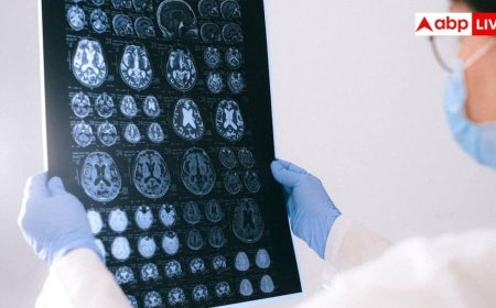30 की उम्र में क्यों बढ़ रहा है ब्रेन फॉग? डॉक्टर ने बताए इसके कारण और बचाव के तरीके