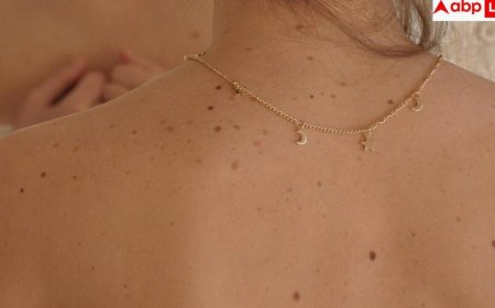 Psoriasis Symptoms: क्या सच में नहीं होता सोराइसिस का कोई इलाज, जानें कितनी खतरनाक है यह बीमारी?