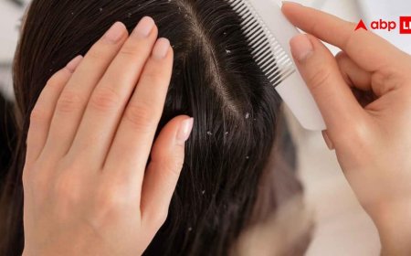 गर्मियों में डैंड्रफ की हो जाएगी ऐसी-तैसी, यूज करेंगी ये 5 हेयर ऑयल तो आ जाएगा मजा