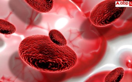 Severe Aplastic Anemia: सीवियर एप्लास्टिक एनीमिया छीन लेता सांसें, जानें स्टेम सेल डोनर ने कैसे बचाई लड़के की जान?