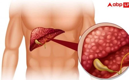 Liver Disease Symptoms: क्या आपकी हथेलियां भी रहती हैं लाल? डॉक्टर ने दी चेतावनी, लिवर की बीमारी का हो सकता है संकेत