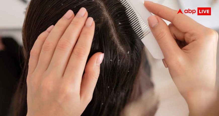 गर्मियों में डैंड्रफ की हो जाएगी ऐसी-तैसी, यूज करेंगी ये 5 हेयर ऑयल तो आ जाएगा मजा