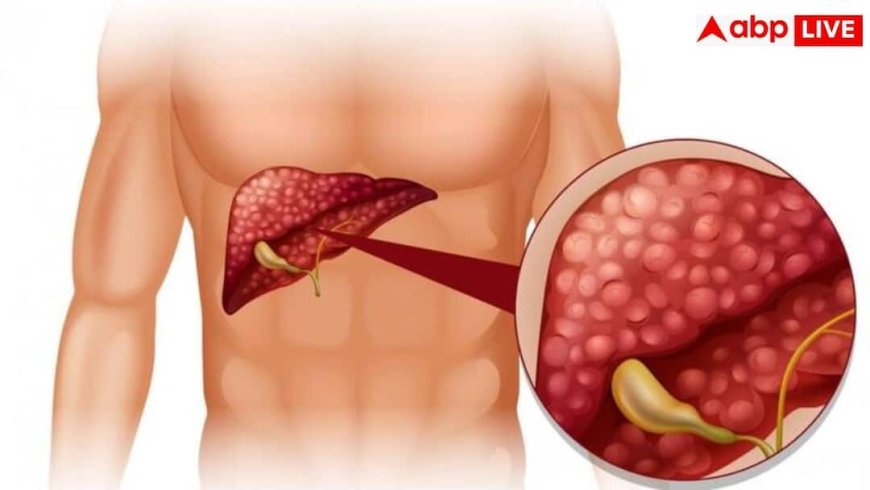Liver Disease Symptoms: क्या आपकी हथेलियां भी रहती हैं लाल? डॉक्टर ने दी चेतावनी, लिवर की बीमारी का हो सकता है संकेत