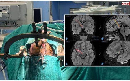 Laughing Epilepsy Symptoms: आपकी हंसी भी हो सकती है खतरनाक बीमारी, जानें इसके लक्षण और इलाज का तरीका