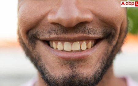 Sugar Effects On Teeth: क्या चीनी खाने से पीले होते हैं दांत, जानें इससे डायबिटीज के अलावा क्या हो सकती हैं दिक्कतें?