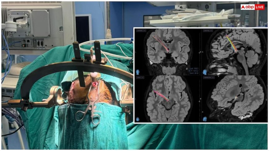 Laughing Epilepsy Symptoms: आपकी हंसी भी हो सकती है खतरनाक बीमारी, जानें इसके लक्षण और इलाज का तरीका