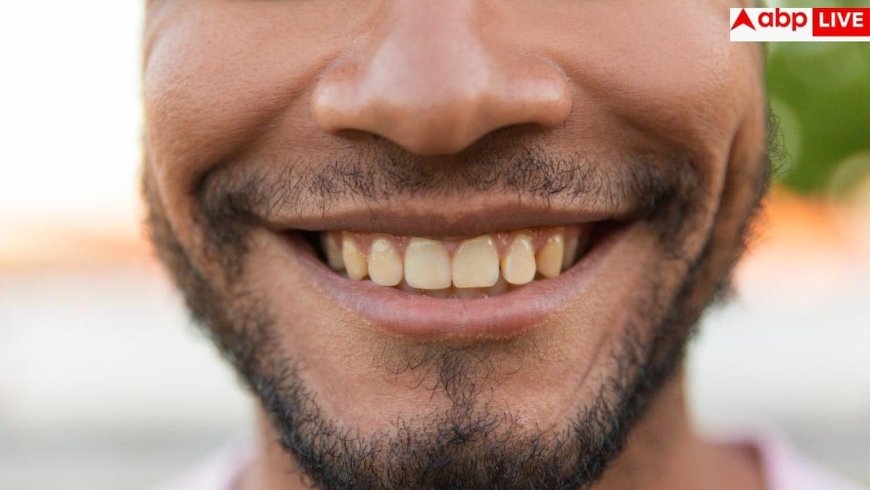 Sugar Effects On Teeth: क्या चीनी खाने से पीले होते हैं दांत, जानें इससे डायबिटीज के अलावा क्या हो सकती हैं दिक्कतें?