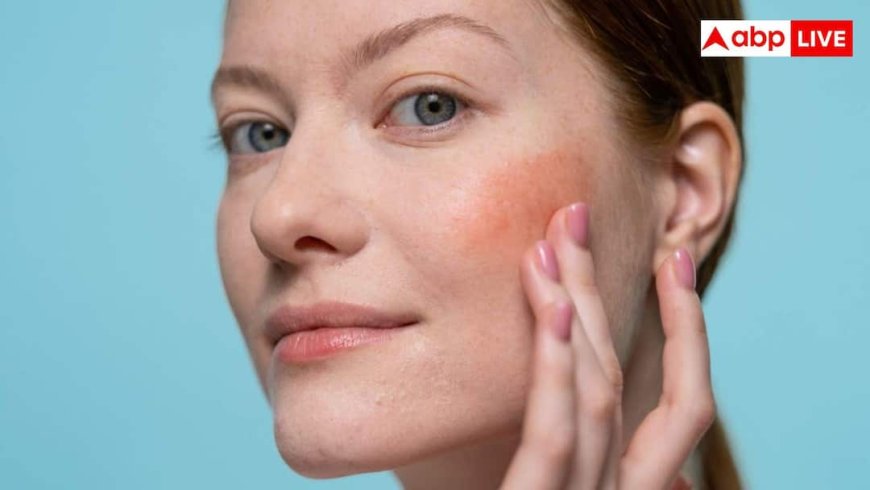 स्किन बैरियर क्यों होता है डैमेज? डर्मेटोलॉजिस्ट ने बताए इसके 3 बड़े कारण और बचाव के टिप्स