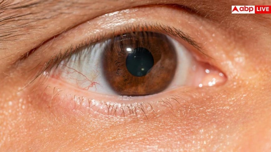 Imran Khan Wife Health Update: इमरान खान की बेगम बुशरा बीबी को हुआ 'रेटिनल डिटैचमेंट', जानें क्या है आंखों की यह गंभीर बीमारी?