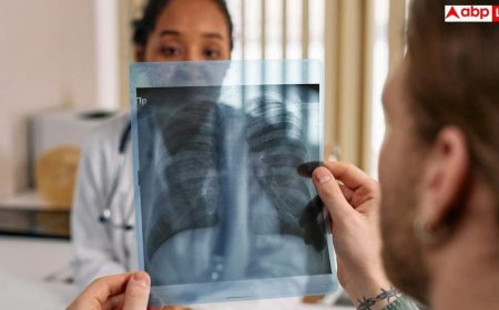 Delhi TB Screening: राजधानी में टीबी के खिलाफ बड़ी कार्रवाई, स्लम और हाई रिस्क इलाकों से सामने आए 12000 मरीज