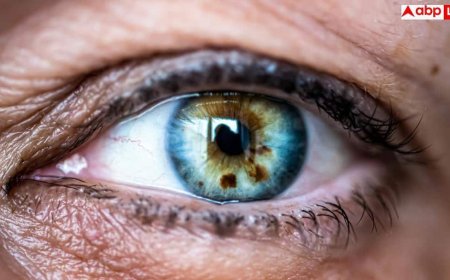 Eye Cancer Risk Factors: आंखों में रहता है दर्द या दिखाई देने लगा है धुंधला तो हल्के में न लें, हो सकता है EYE कैंसर