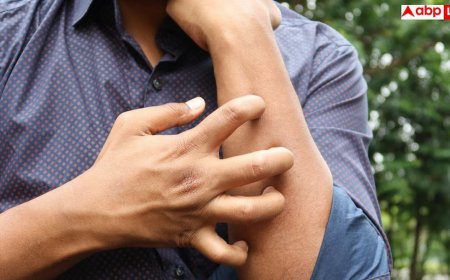 Summer Fungal Infection: गर्मियों में फंगल इंफेक्शन से हैं परेशान, आज ही छोड़ दें ये गलतियां