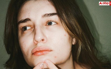 Pimples Before Periods: पीरियड्स से पहले चेहरे पर आने लगते हैं पिंपल्स, समझिए शरीर का ये खास इशारा