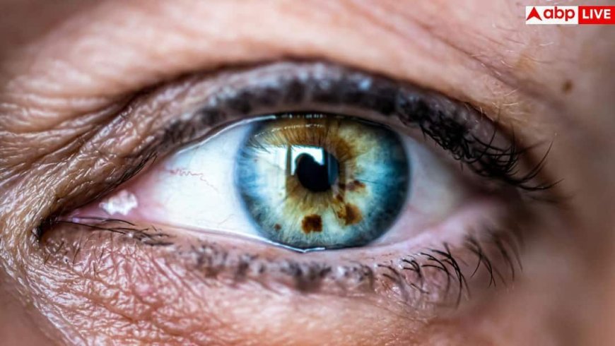 Eye Cancer Risk Factors: आंखों में रहता है दर्द या दिखाई देने लगा है धुंधला तो हल्के में न लें, हो सकता है EYE कैंसर