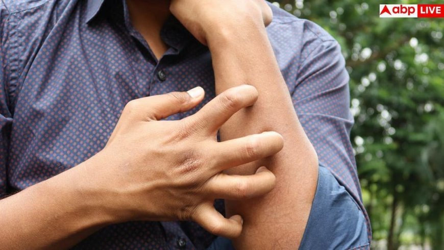 Summer Fungal Infection: गर्मियों में फंगल इंफेक्शन से हैं परेशान, आज ही छोड़ दें ये गलतियां