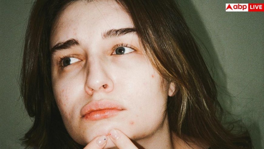 Pimples Before Periods: पीरियड्स से पहले चेहरे पर आने लगते हैं पिंपल्स, समझिए शरीर का ये खास इशारा
