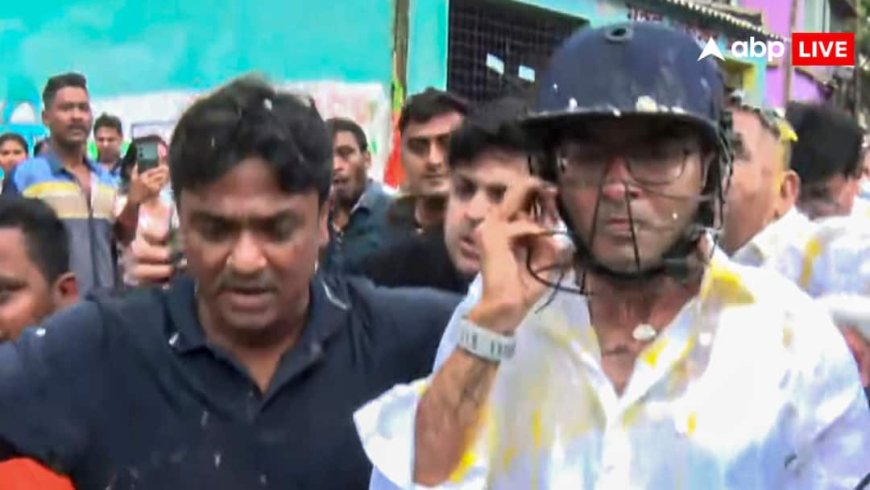 हमले में अभिषेक बनर्जी को नहीं आई कोई गंभीर चोट? चेकअप करने वाले डॉक्टर ने MLC रिपोर्ट में क्या बताया