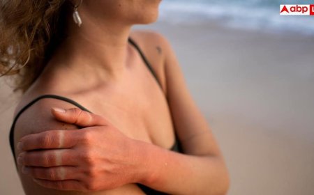 Itchy Skin In Summer: रोज नहाते हैं फिर भी गर्मियों में स्किन पर होती है खुजली, ये तरीके आजमाए तो तुरंत मिलेगी राहत