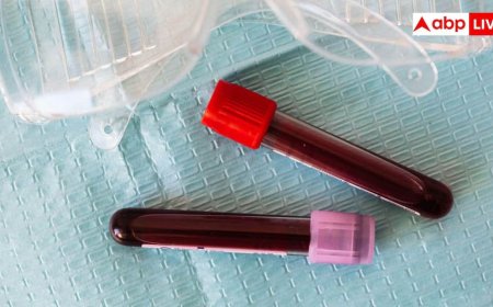 Nipah Outbreak in Kerala: केरल में निपाह वायरस की दस्तक, जानें यह कैसे फैलता है और कितना खतरनाक?