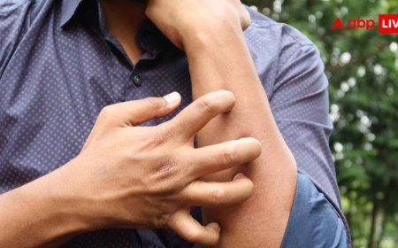 Heat Rash And Prickly Heat Home Remedies: चुभती-जलती गर्मी में शुरू हो गया घमौरियों मौसम, ऐसे करें अपनी देखभाल