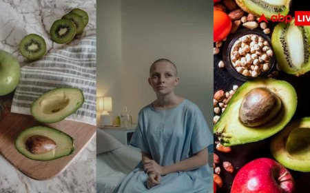 Colon Cancer Prevention Tips: एवोकाडो से कीवी तक... कोलन कैंसर से बचना है तो रोज खाएं ये 5 चीजें, जानें हेल्दी सीक्रेट फूड्स