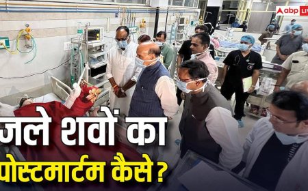 Burnt Body Postmortem: जले हुए शवों का कैसे किया जाता है पोस्टमार्टम? जानिए अस्त व्यस्त बॉडी में क्या और कैसे देख पाते हैं डॉक्टर