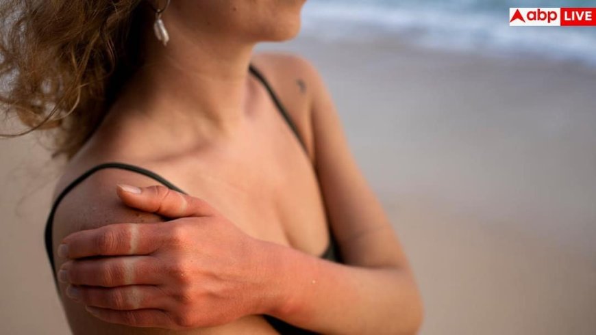 Itchy Skin In Summer: रोज नहाते हैं फिर भी गर्मियों में स्किन पर होती है खुजली, ये तरीके आजमाए तो तुरंत मिलेगी राहत