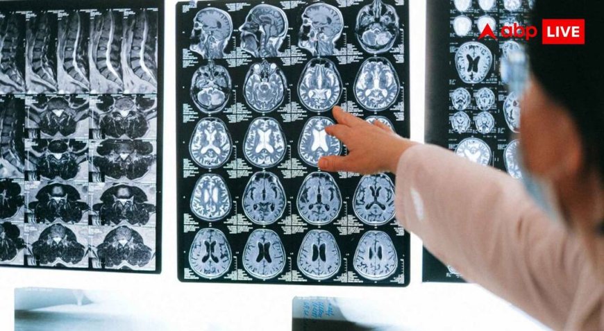 3D Atlas Human Brainstem: IIT मद्रास ने जारी किया इंसानी ब्रेनस्टेम का 3D एटलस, मेडिकल साइंस के लिए कितना खास?