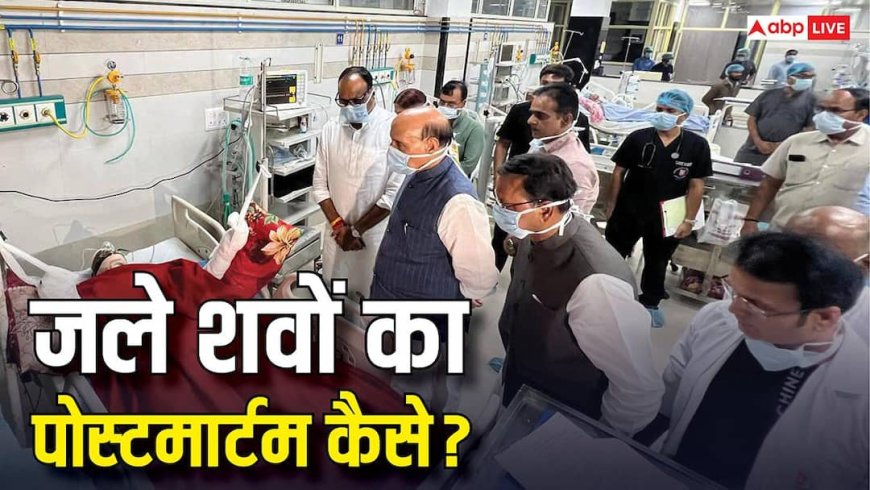 Burnt Body Postmortem: जले हुए शवों का कैसे किया जाता है पोस्टमार्टम? जानिए अस्त व्यस्त बॉडी में क्या और कैसे देख पाते हैं डॉक्टर